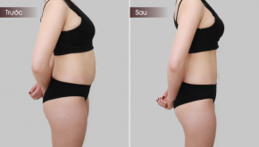 Chia sẻ bí quyết giảm 15 cm mỡ bụng thành công