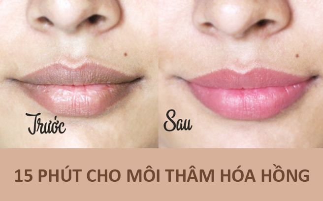 15 phút cho môi thâm xỉn trở nên hồng hào