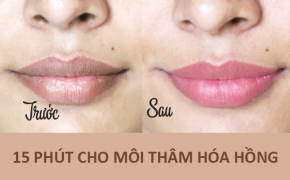 15 phút cho môi thâm xỉn trở nên hồng hào