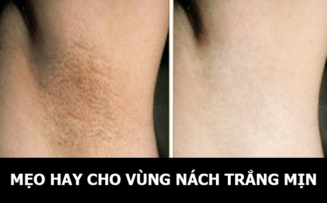 Mẹo hay cho vùng nách trắng mịn