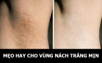 Mẹo hay cho vùng nách trắng mịn