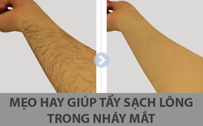 Mẹo hay giúp bạn gái tẩy sạch lông trong nháy mắt