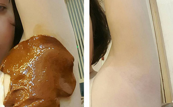 Hướng dẫn wax lông, trị thâm nách tích tắc với chanh đào tại nhà