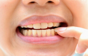 Đánh sạch mảng bám răng chỉ trong 5 phút!