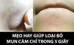 Mẹo hay giúp lấy sạch mụn cám, mụn đầu đen trên da chỉ trong 5 giây!