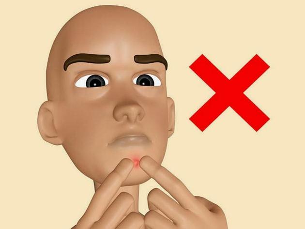Không nên nặn mụn ở những vùng “tử thần” nào?