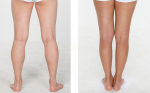 Hướng dẫn 4 động tác giúp đánh tan mỡ bắp chân hiệu quả