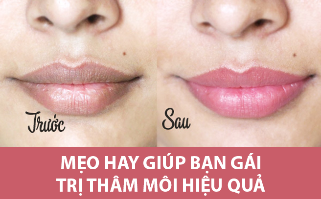 Học nhanh bí quyết trị thâm môi chỉ với chanh tươi!