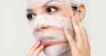 Tuyệt chiêu đánh bay sẹo hiệu quả bạn chưa biết