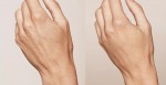 Làm thế nào để cải thiện làn da tay gân guốc?