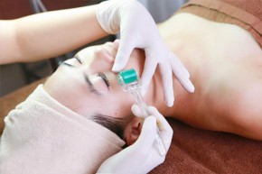 Lăn kim để làm đẹp - cẩn trọng nhé!
