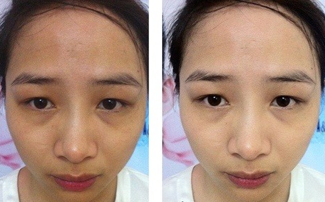 Tuyệt chiêu giúp da trắng sáng chỉ với 5000đồng!