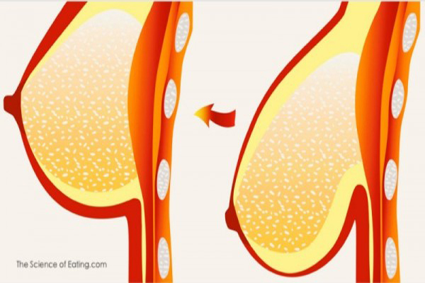 Mát xa “núi đồi” với hỗn hợp này – Vòng 1 chảy xệ cũng săn chắc như gái đôi mươi