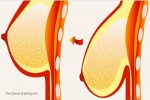Mát xa “núi đồi” với hỗn hợp này – Vòng 1 chảy xệ cũng săn chắc như gái đôi mươi