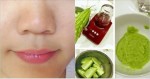 Muốn Đẩy Mụn Ẩn, Đừng Quên Mặt Nạ Mướp Đắng