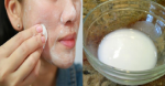 Da mịn như da em bé nhờ sử dụng hỗn hợp này 5 phút 1 tuần