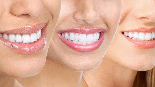 Răng trắng sáng như gương, hơi thở thơm tho chỉ trong 1 phút
