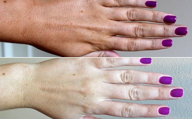 Mách bạn bí quyết da ngăm hóa trắng thần kỳ