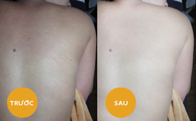 Quy trình dưỡng trắng da 7 ngày đẹp như đi Spa