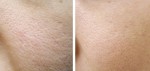 Thu nhỏ lỗ chân lông với phương pháp rửa mặt mới