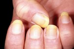 Dấu hiệu cơ thể cảnh báo bệnh tật