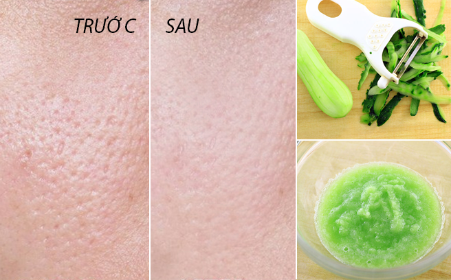 Áp dụng ngay công thức se lỗ chân lông thần thành từ dưa chuột và bia