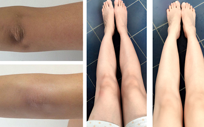 Mẹo nhỏ khi tắm cho đầu gối trắng nõn nà
