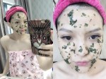 Em đã diệt sạch mụn, sáng da và ngăn lão hóa chỉ với rau diếp cá