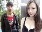 Tôi đã “lột xác” nhờ tắm trắng bằng bột đậu đỏ