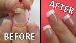 Mẹo "vá" móng gãy bằng túi trà