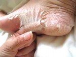 Công thức giúp bạn lột bỏ làn da rắn thô ráp nhanh chóng nhất