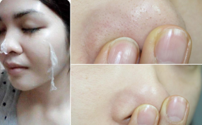 Tự chế mặt nạ lột dưỡng trắng da loại sạch mụn cám bằng nước trái cây tươi