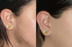 Cách Tự Tẩy Lông Mặt Tại Nhà An Toàn, Không Trầy Xước