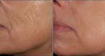 Tạm biệt toàn bộ nếp nhăn chỉ trong 1 tuần với ‘phép lạ’ tự nhiên này!
