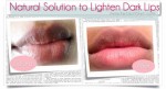 Hô biến môi thâm sì thành hồng hào tự nhiên chỉ trong 10 phút