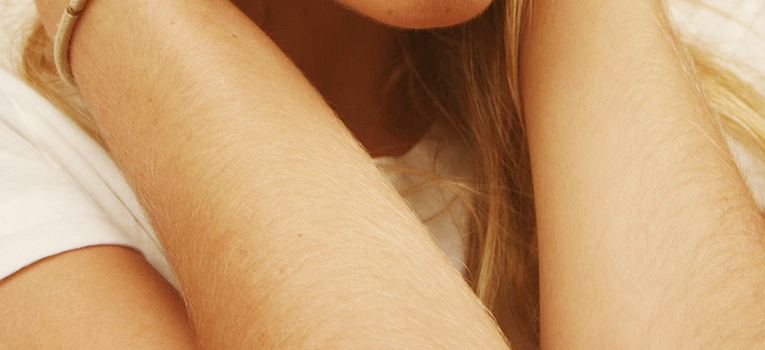 4 Nguyên nhân khiên lông trên cơ thể mọc nhiều