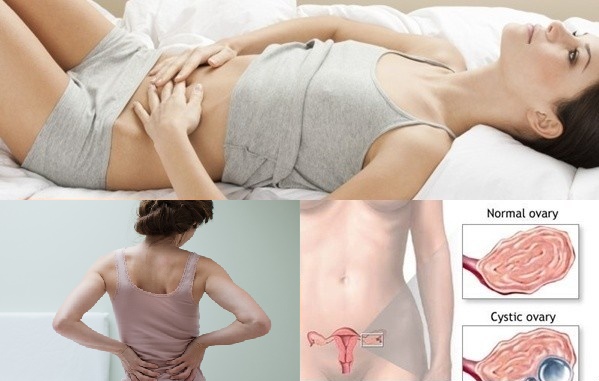 Là phụ nữ, đừng bỏ qua 10 triệu chứng của kẻ giết người thầm lặng này!