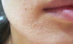 Cách đơn giản để da không bị khô, nứt nẻ bong tróc vào mùa lạnh