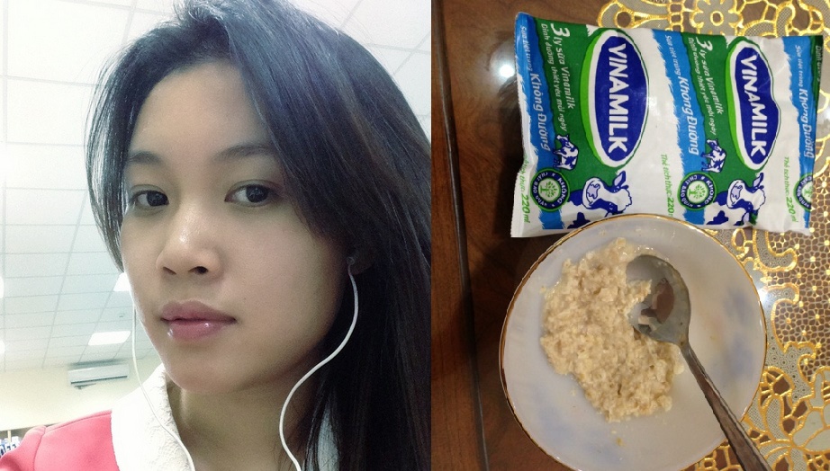 Con đường trị mụn gian khổ - Chia sẻ kinh nghiệm