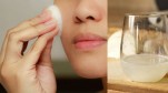 Xóa sạch lũ mụn đáng ghét chỉ bằng 1 nguyên liệu duy nhất