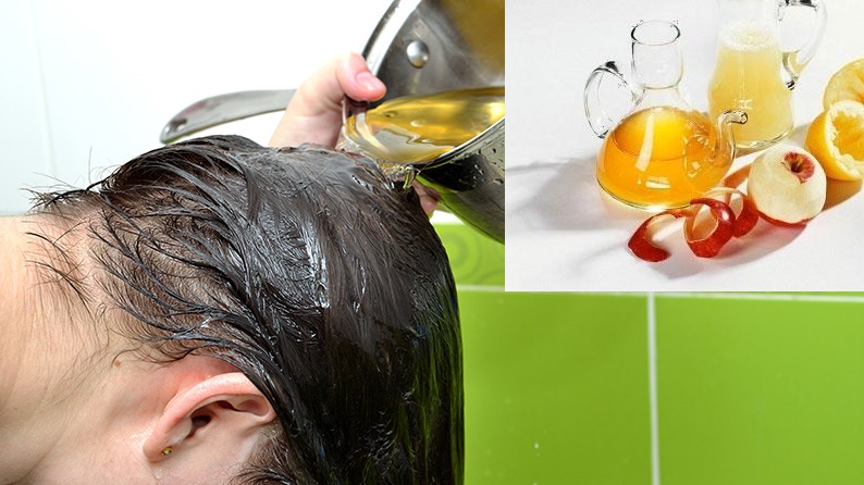 Mách bạn cách trị gàu tại nhà đơn giản mà hiệu quả nhất