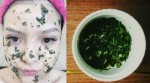 Rau diếp cá trị mụn và vết thâm mụn hiệu quả