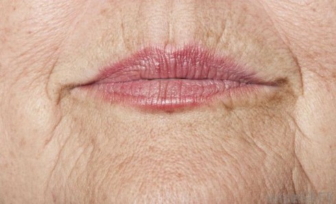 Hãy để những nếp nhăn biến mất mãi mãi với mặt nạ rẻ tiền này