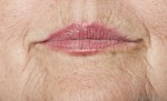 Hãy để những nếp nhăn biến mất mãi mãi với mặt nạ rẻ tiền này