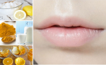 5 bí quyết đơn giản giúp thôi bay môi thâm khô xỉn màu!