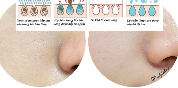 Se khít lỗ chân lông thật dễ dàng nhờ thứ không ai ngờ tới
