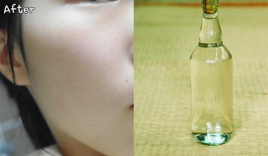 Da trắng sáng không tì vết sau 5 ngày chỉ với loại "nước Thánh" này