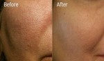 Cách se nhỏ lỗ chân lông hiệu quả hơn các loại kem đắt tiền