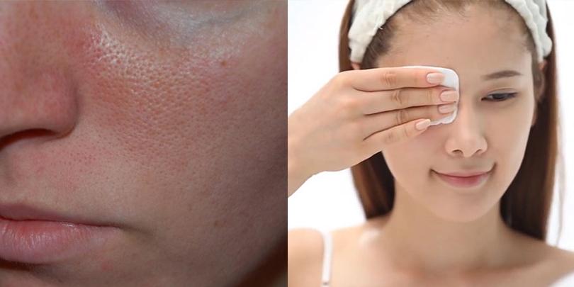 Hậu quả khủng khiếp khi không tẩy trang kỹ khiến bạn không khỏi giật mình