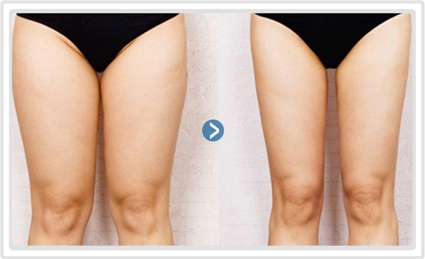 Giảm Ngay 3cm Vòng Đùi với phương pháp cực đơn giản